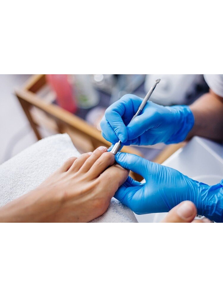 Rinkinys įaugusiems kojų nagams 9 Rinkinys įaugusiems kojų nagams 9